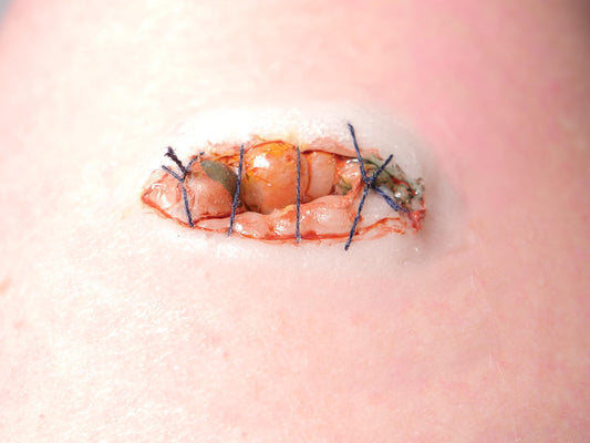 Pre-Painted Silicone Sewn Up Eye Prosthetic – Realistic SFX Wound for Halloween & Film Makeup