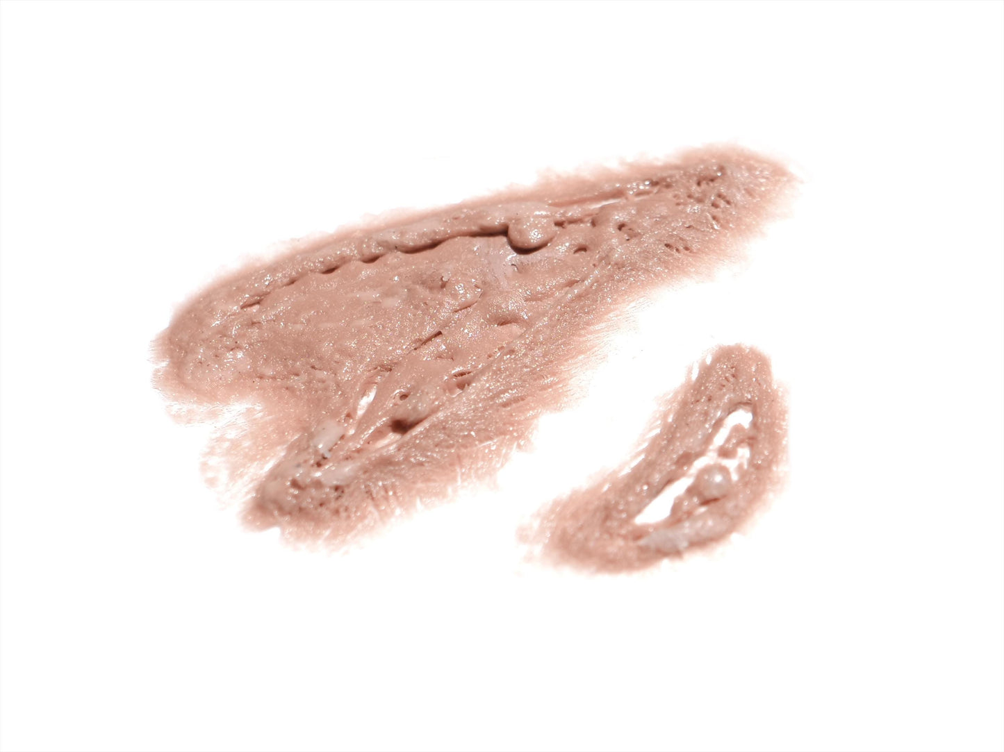 Severe Laceration Transfer