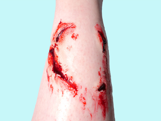 Animal Attack Prosthetics