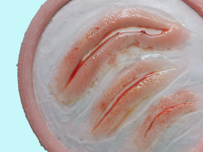 Animal Attack Prosthetics