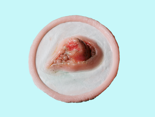 [Item 003] Broken Bone Prosthetic