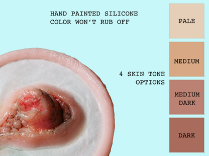 [Item 003] Broken Bone Prosthetic