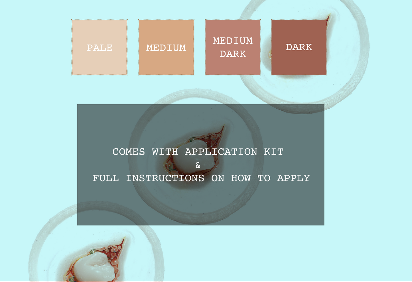 Emerging Broken Bone Prosthetic