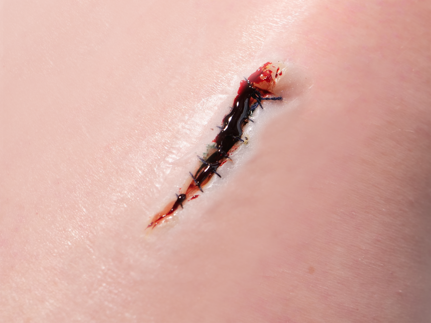 Deep Laceration Prosthetic