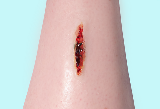 Deep Laceration Prosthetic