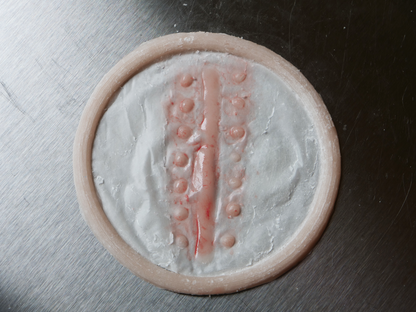 Suture Scar Prosthetic