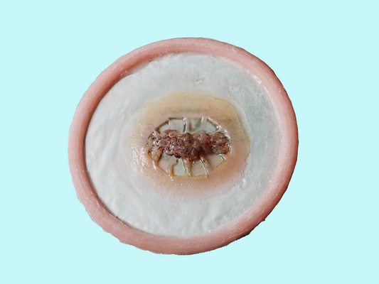 [Item 006] Zombie Bite Prosthetic