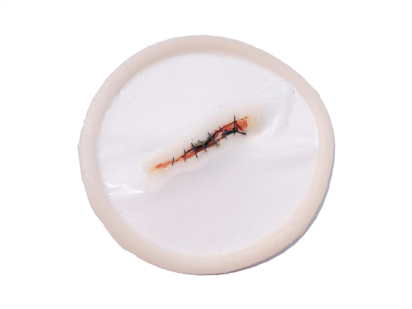 [Item 021: Incision Unit S-9] – Minor Laceration, Sutured