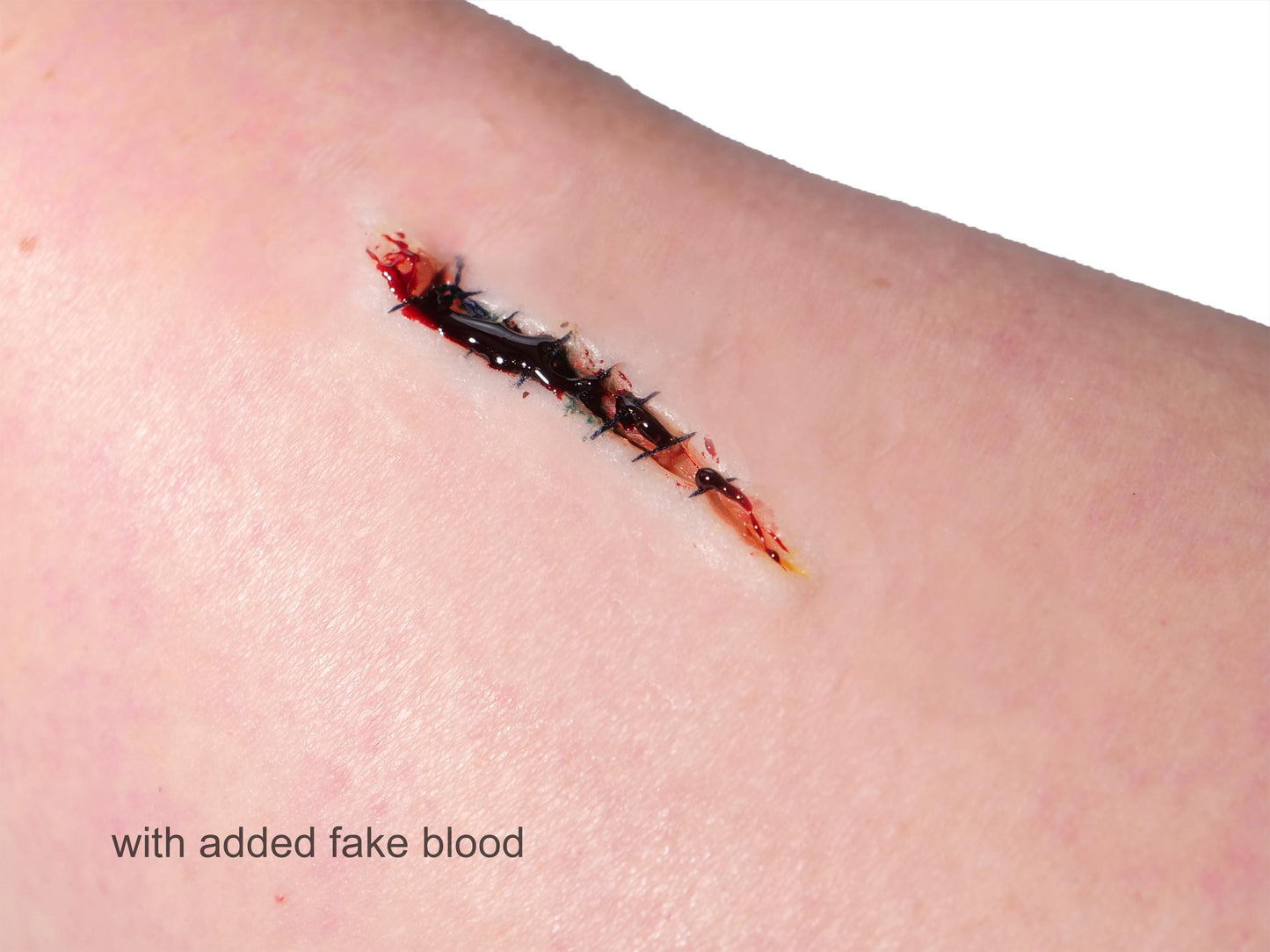 [Item 021: Incision Unit S-9] – Minor Laceration, Sutured
