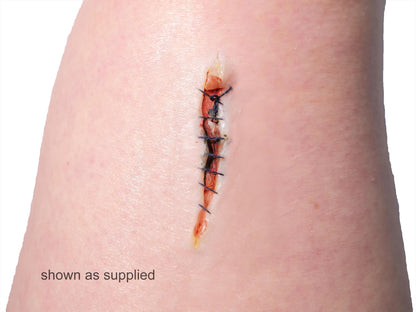 [Item 021: Incision Unit S-9] – Minor Laceration, Sutured