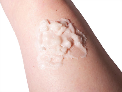 [Item 033: Dermal Failure Z-3] – Thermal Compromise Zone