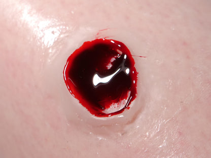 [Item 032: Entry W-45] — Encapsulated Silicone Gunshot Wound Prosthetic
