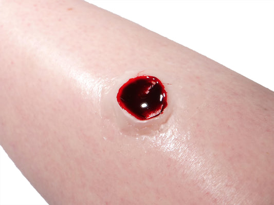 [Item 032: Entry W-45] — Encapsulated Silicone Gunshot Wound Prosthetic