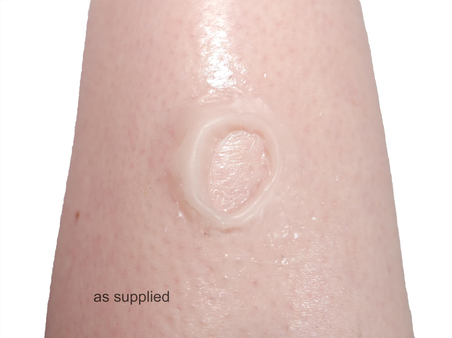 [Item 032: Entry W-45] — Encapsulated Silicone Gunshot Wound Prosthetic