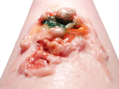 [Item 007: Corrosion Mark A-17] – Acidic Surface Trauma