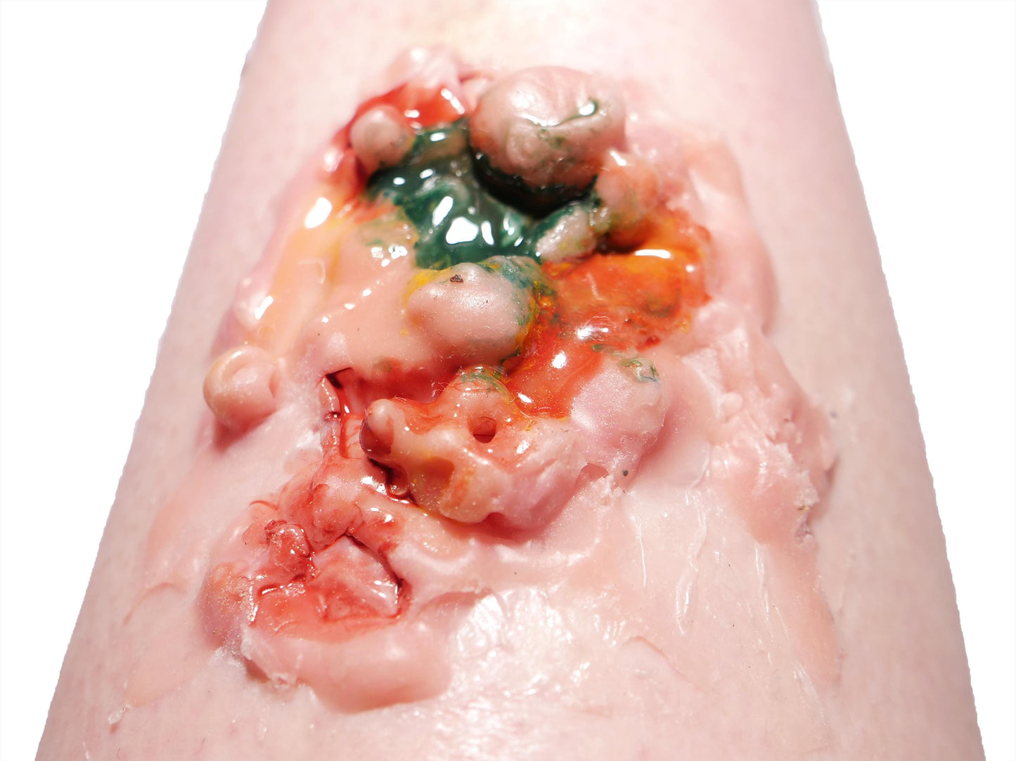 [Item 007: Corrosion Mark A-17] – Acidic Surface Trauma