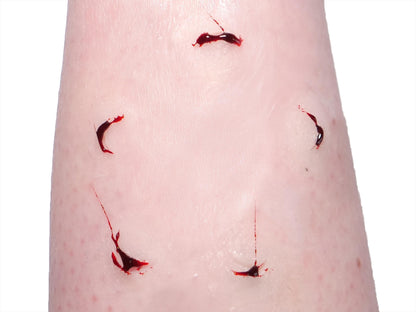 [Item 034: Grasp Residue C-7] – Laceration Cluster: Fingernail Pattern