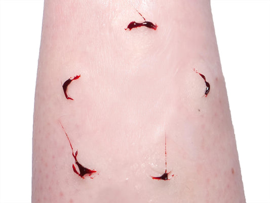 [Item 034: Grasp Residue C-7] – Laceration Cluster: Fingernail Pattern