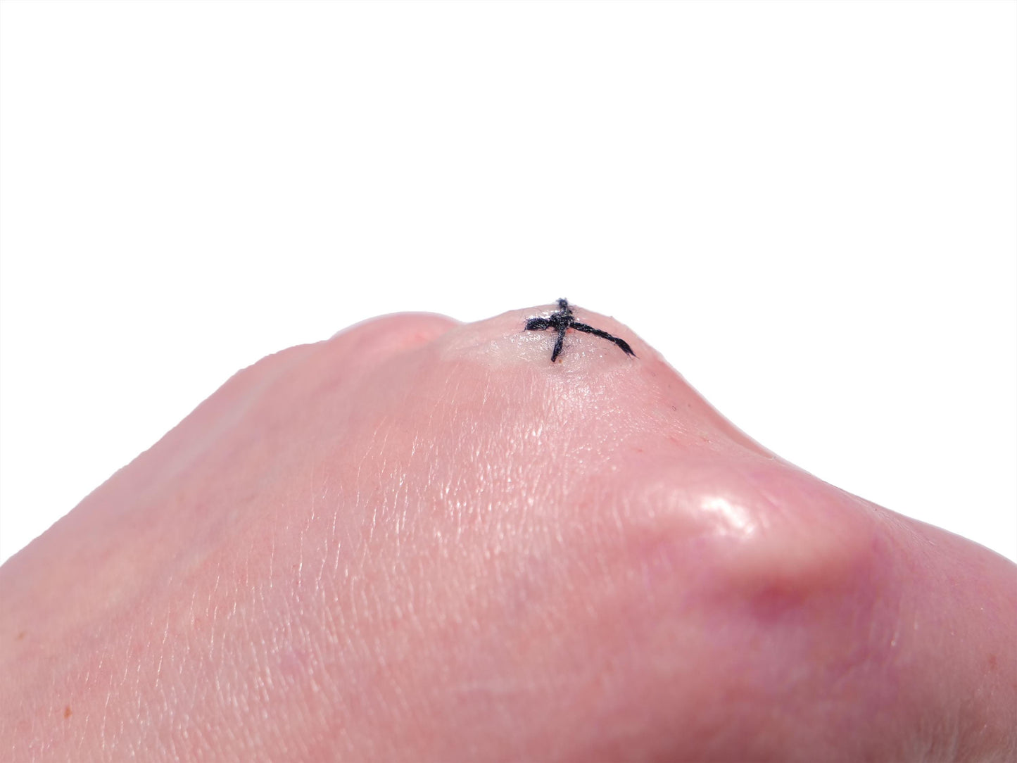 [Item 025: MicroStitch 1-A] – Small Stitched Cut Cluster Prosthetic
