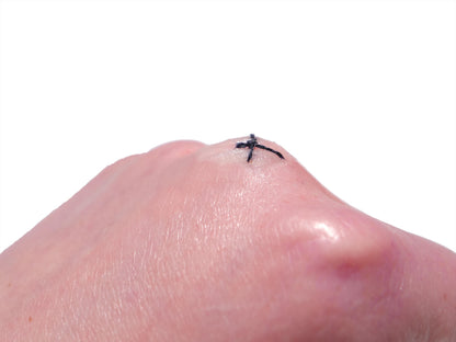 [Item 025: MicroStitch 1-A] – Small Stitched Cut Cluster Prosthetic