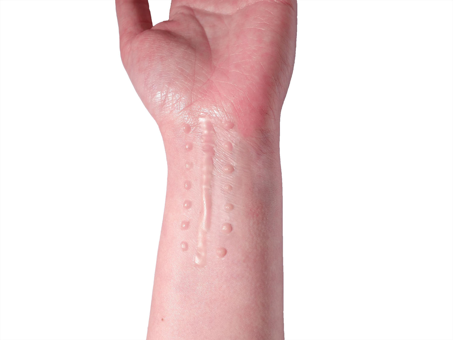 [Item 018: Suture Line S-23] — Silicone Scar Prosthetic