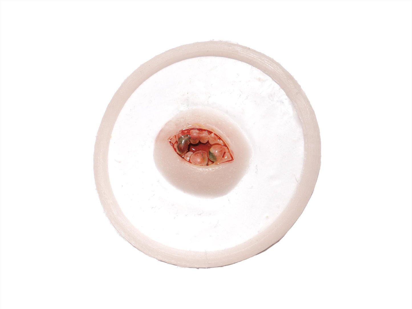[Item 003: Ocular Rupture 52-A] — Pre-Painted Gouged Eye Prosthetic