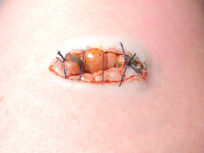 [Item 026: Ocular Suture 9-X] – Sewn Eye Socket Trauma Prosthetic