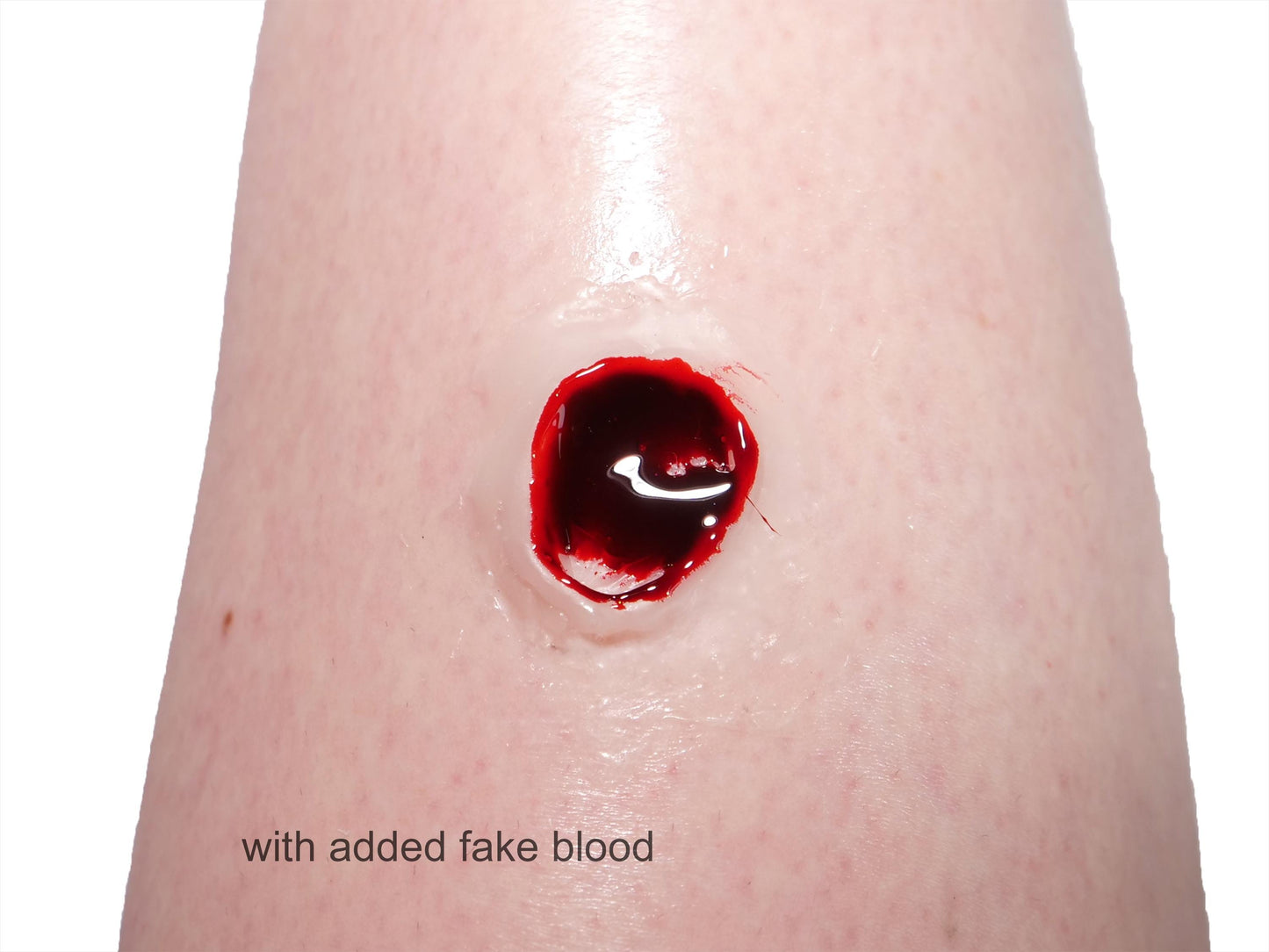 [Item 032: Entry W-45] — Encapsulated Silicone Gunshot Wound Prosthetic