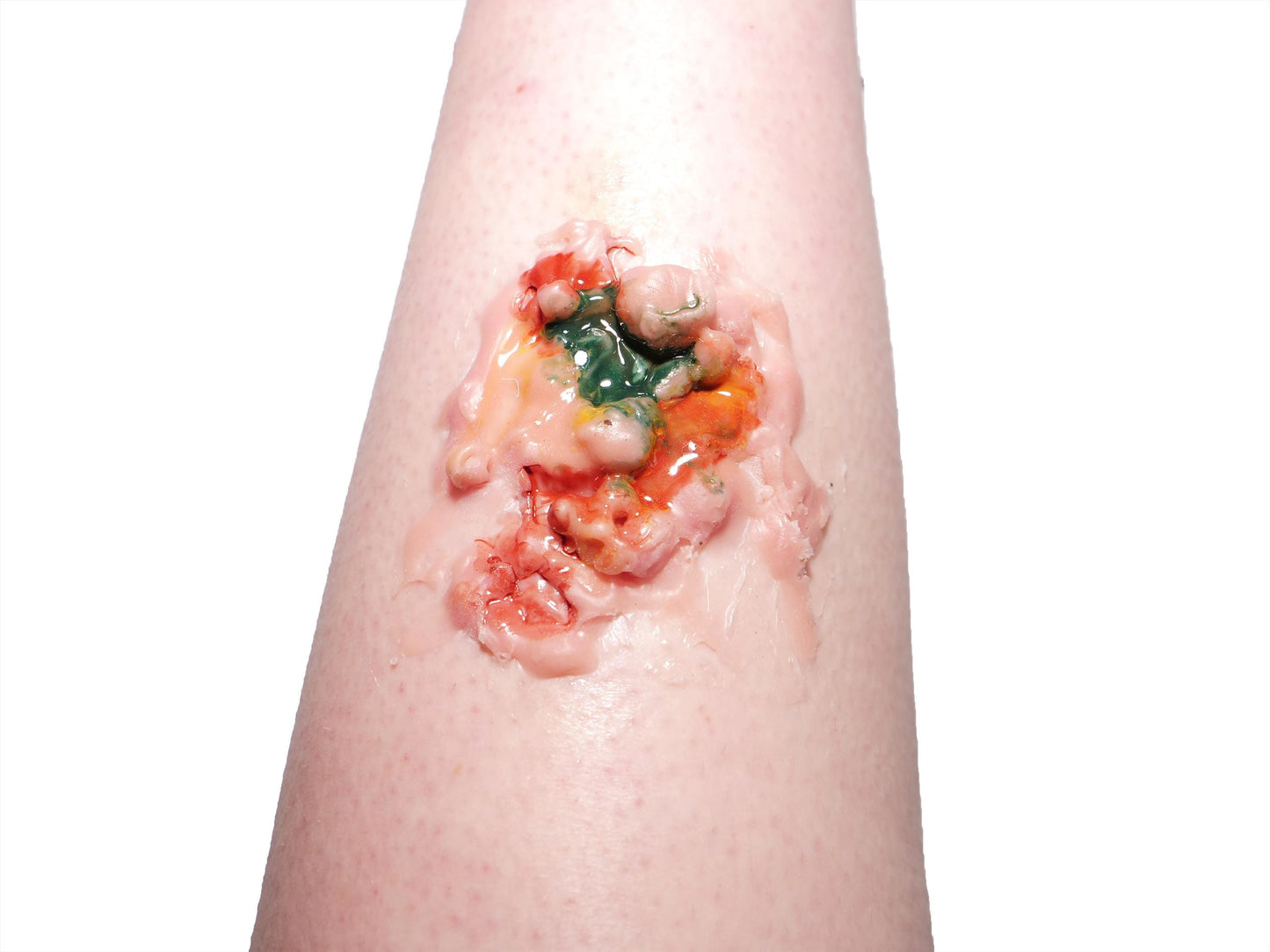 [Item 007: Corrosion Mark A-17] – Acidic Surface Trauma