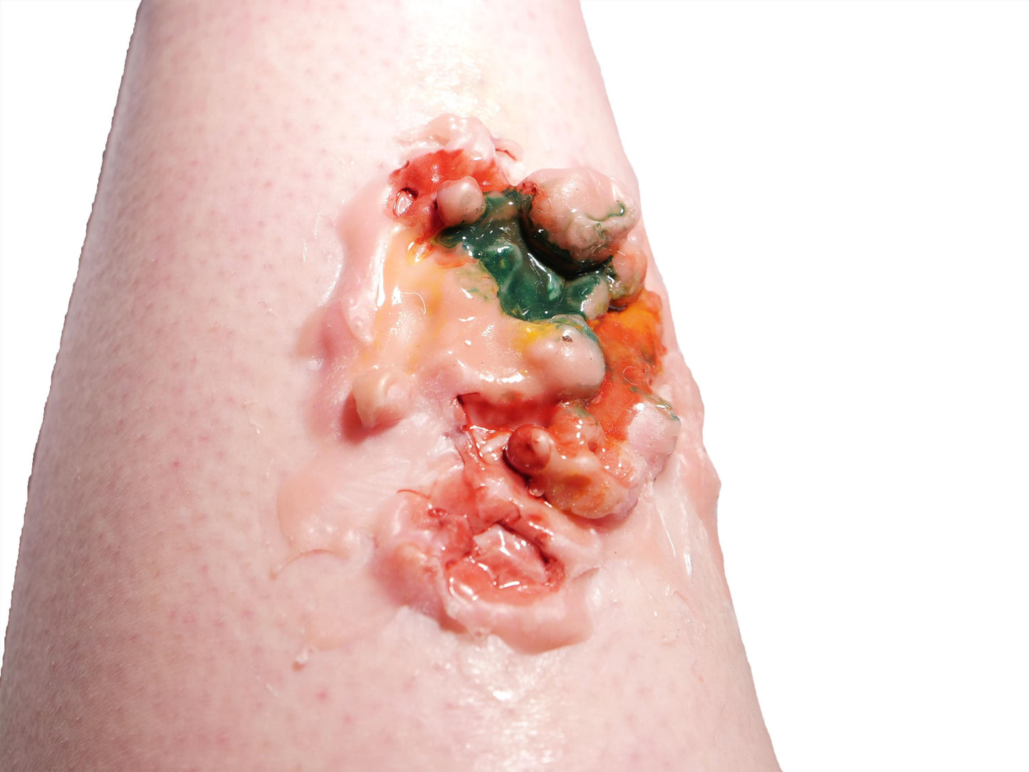 [Item 007: Corrosion Mark A-17] – Acidic Surface Trauma