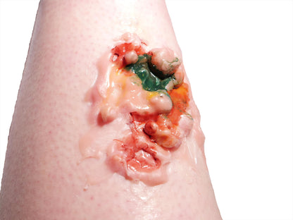 [Item 007: Corrosion Mark A-17] – Acidic Surface Trauma