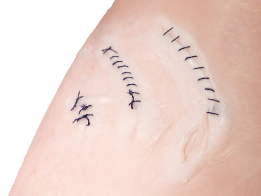 [Item 024: Lacerate 3-Z] – Stitched Claw Wound Prosthetic