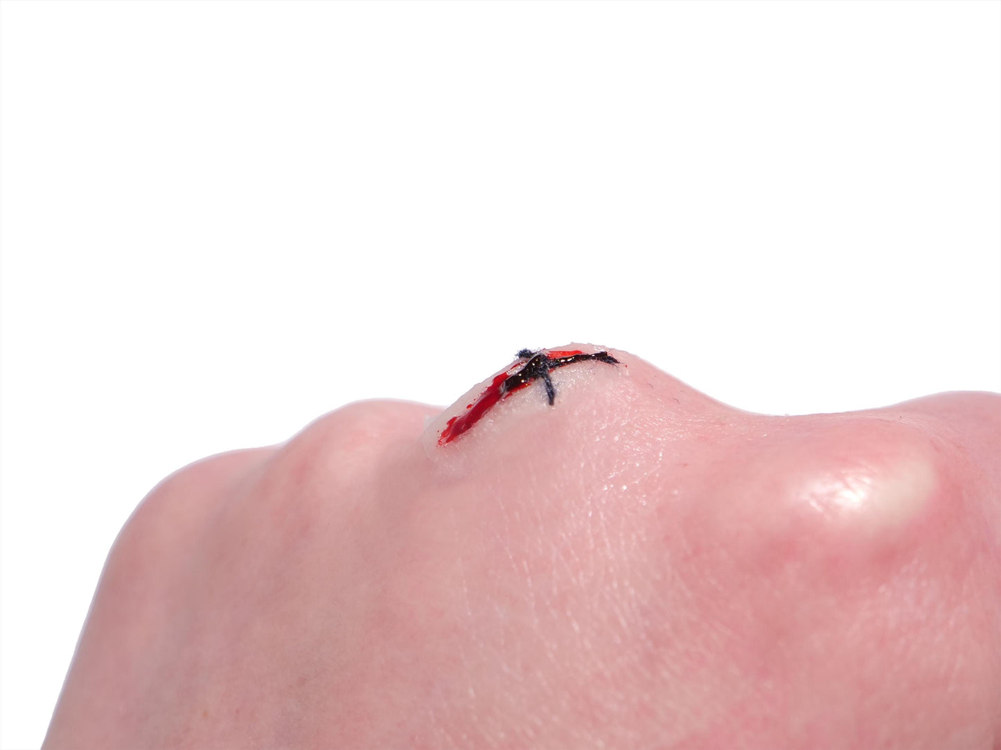 [Item 025: MicroStitch 1-A] – Small Stitched Cut Cluster Prosthetic
