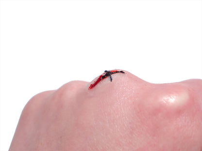 [Item 025: MicroStitch 1-A] – Small Stitched Cut Cluster Prosthetic
