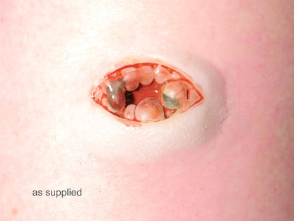 [Item 003: Ocular Rupture 52-A] — Pre-Painted Gouged Eye Prosthetic