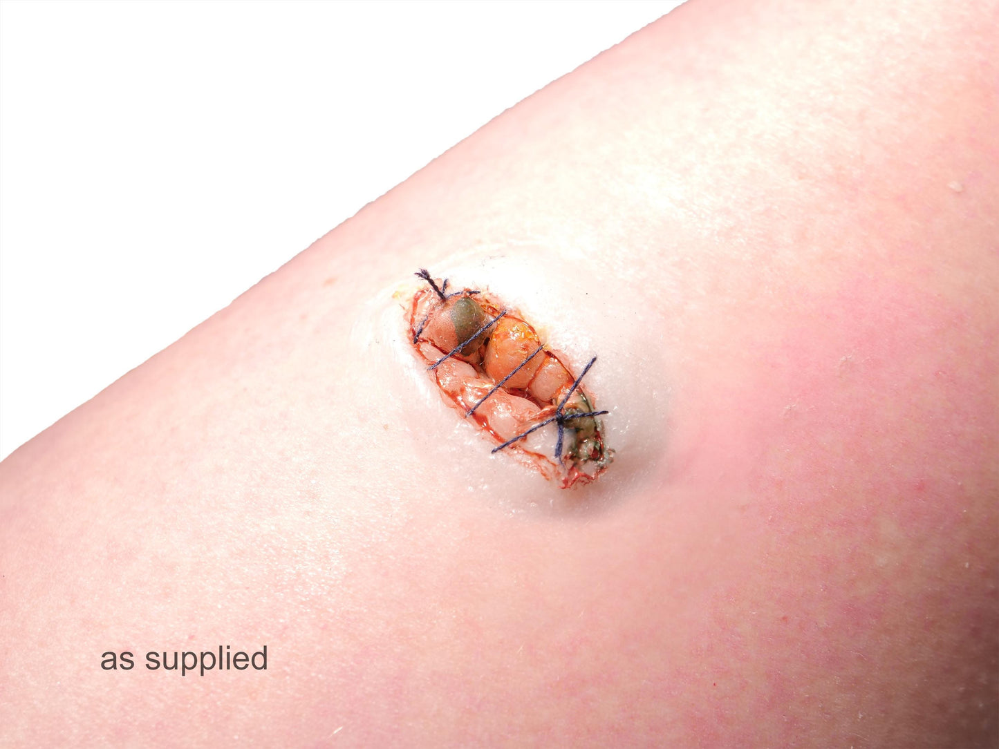 [Item 026: Ocular Suture 9-X] – Sewn Eye Socket Trauma Prosthetic