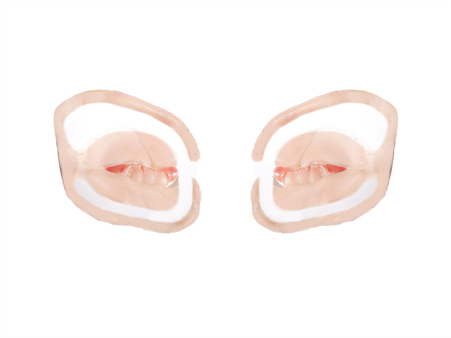 [Item 301: Grin R-70] — Chelsea Smile Reveal Prosthetic