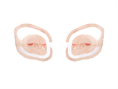 [Item 301: Grin R-70] — Chelsea Smile Reveal Prosthetic