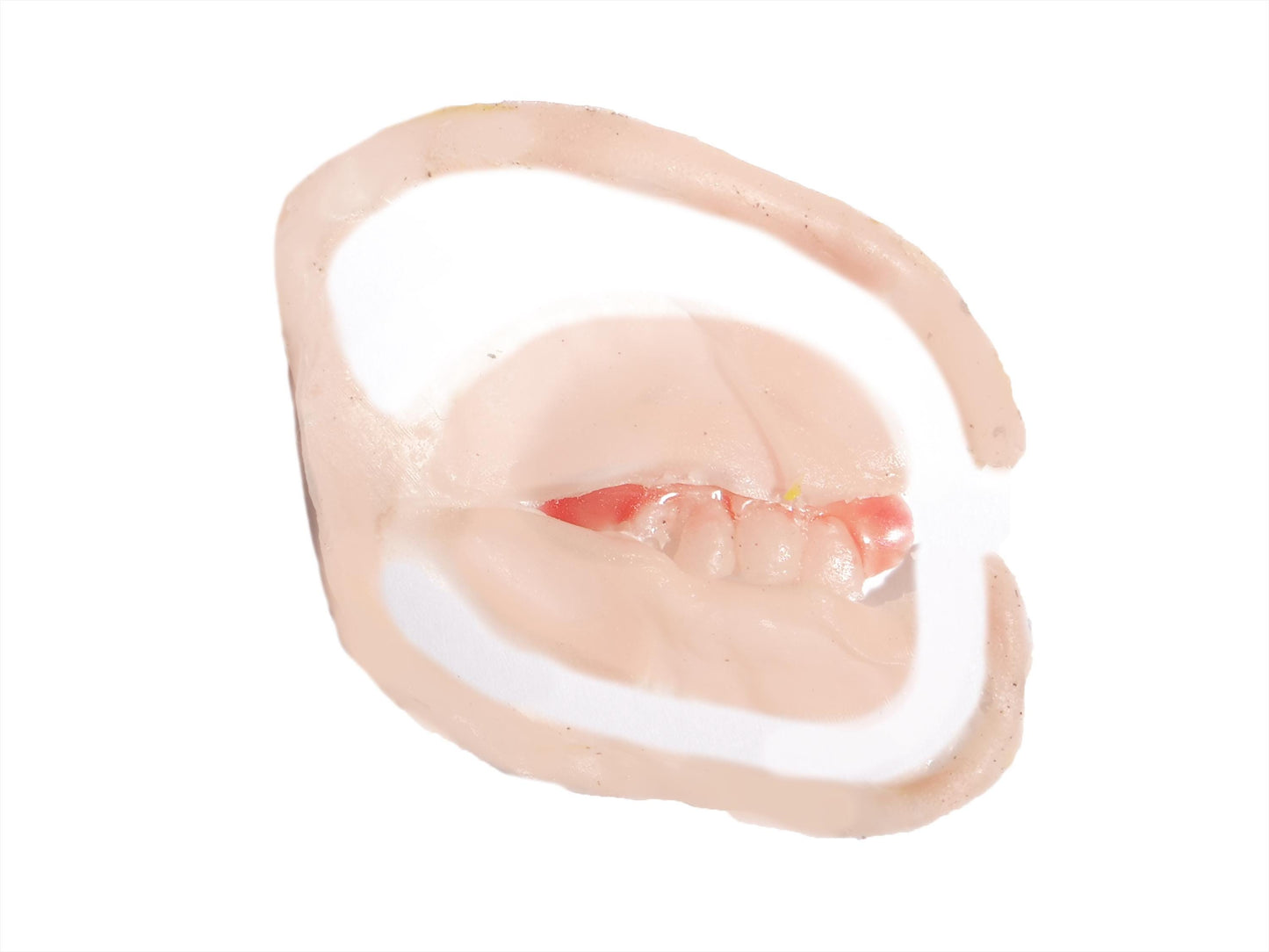 [Item 301: Grin R-70] — Chelsea Smile Reveal Prosthetic