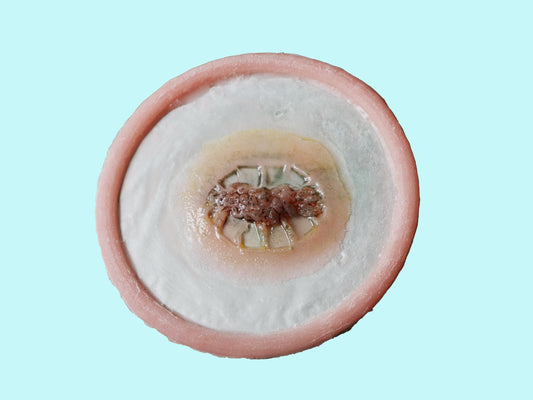 Zombie Bite Prosthetic - Undead Infection Entry Wound with Epidermal Tear & Subdermal Trauma